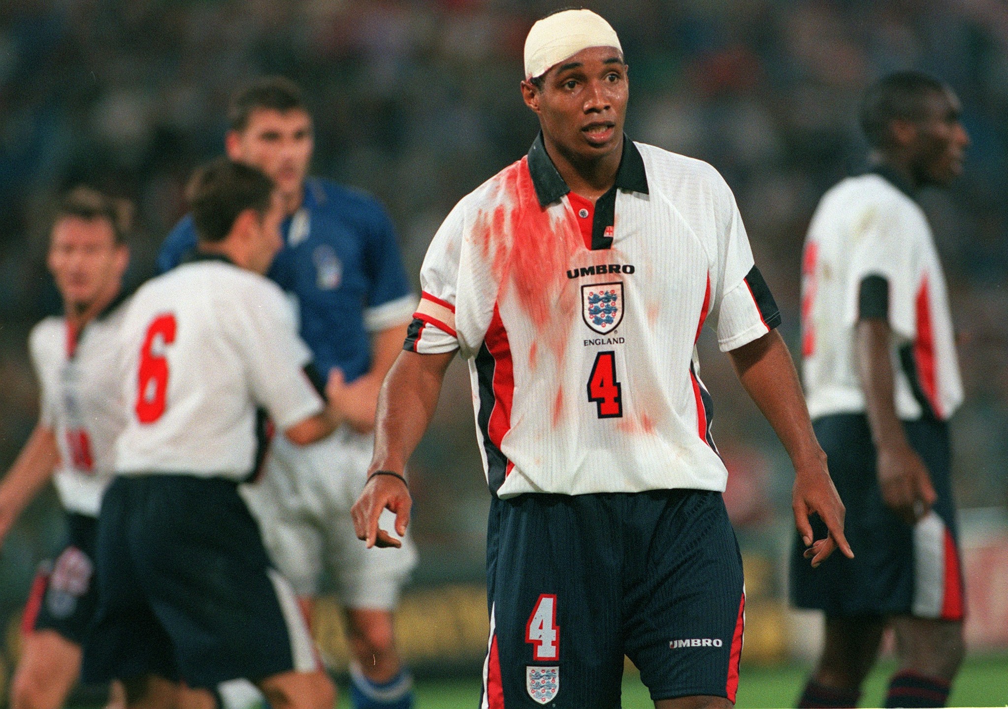 Throwback to When the Guveee Paul Ince was bloodied in battle. How good was the Guveee?#govnor #paulince #thegovenor #england #guvee #legendsthatshooktheblog