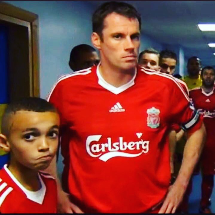 Alexander Arnold as a Mascot makes our pic of the Day